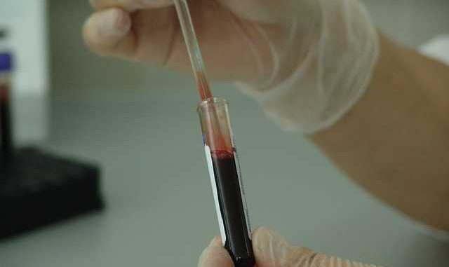 Journée mondiale du cancer OMS appelle à faire plus pour éliminer le cancer du col utérin Journée mondiale du cancer OMS appelle à faire plus pour éliminer le cancer du col utérin