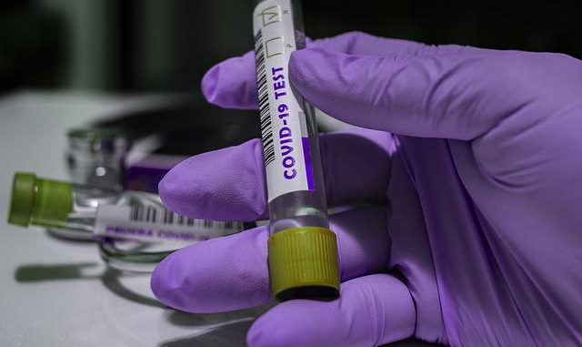 Coronavirus. un nouveau foyer épidémique détecté à Blagnac Coronavirus. un nouveau foyer épidémique détecté à Blagnac