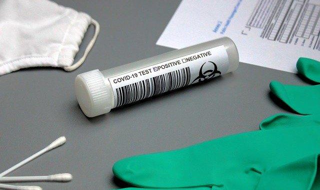 Coronavirus ce qu'il faut savoir avant de se faire dépister Coronavirus ce qu'il faut savoir avant de se faire dépister